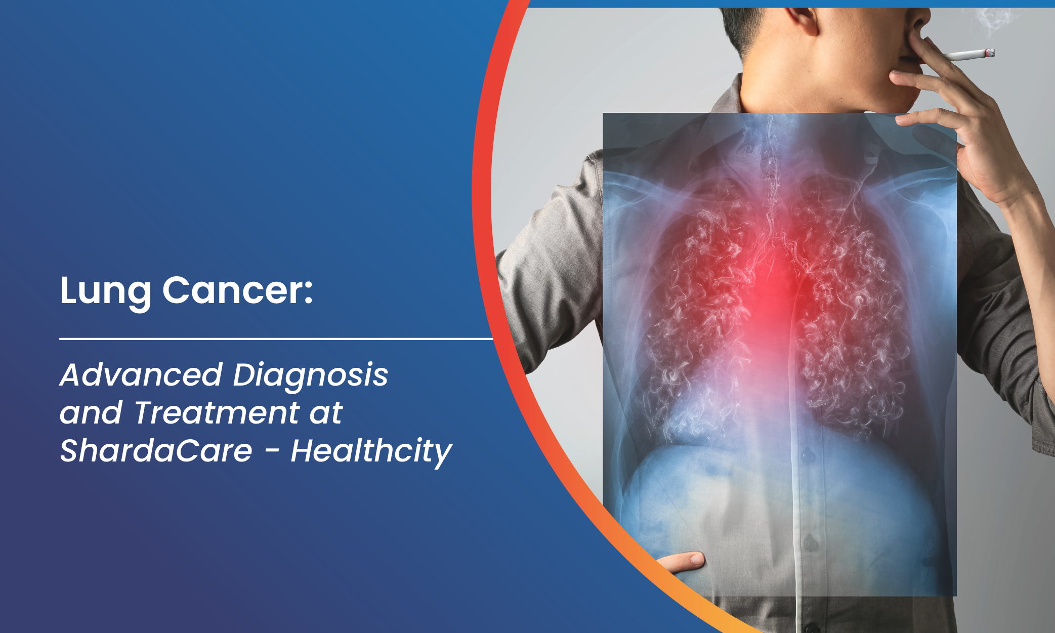 World Lung Cancer Day 2025: Breaking Barriers for Awareness, Early Detection, and Equal Care